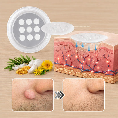 🎁 -50% AKCIÓ! PURESHADE® 2 az 1-ben mikrotűs és hidrokolloid tapasz 🍀 | Láthatatlan tapasz arcra és testre | Bőrhibák, aknék és bőröregedés jeleinek ápolására