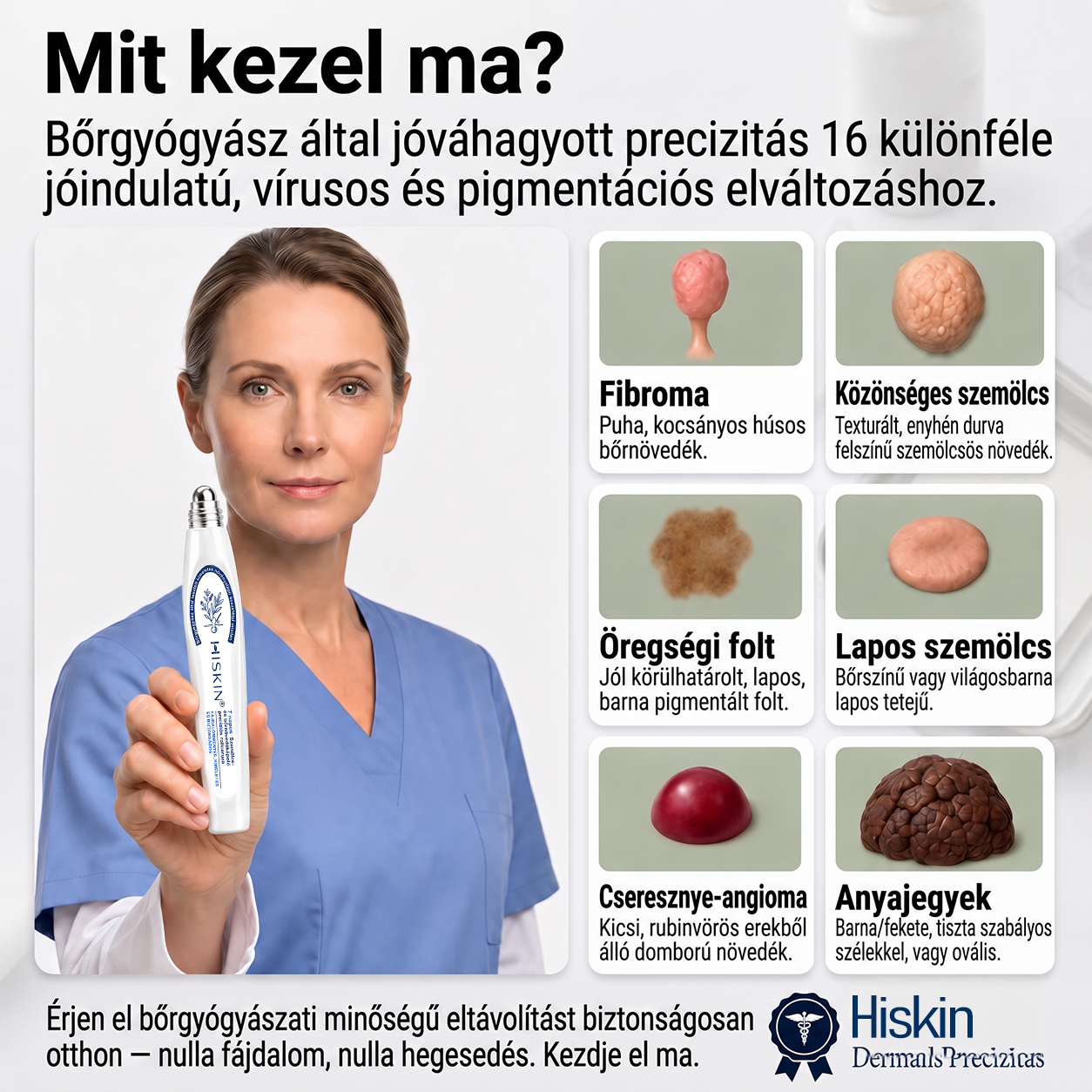 ✨ 🔥 Most 50% kedvezménnyel elérhető! ✨🚢 Hiskin® 7 napos Szemölcseltávolító Roll-on Ápoló Folyadék (Fájdalommentes rollerball technológia, hegek nélkül) 🐬