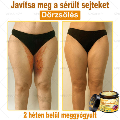 🔥🔥 Már csak 5 lehetőség! Használd ki a 50% kedvezményt! APKAPK® 🐝 Méhméreg krém segít a ráncok, hegek, pigmentfoltok, striák, akné és egyéb bőrproblémák kezelésében. Ne hagyd ki – kattints a linkre és élvezd a kedvezményt még ma! 🛒💚