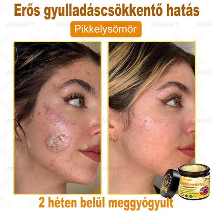 🔥🔥 Már csak 5 lehetőség! Használd ki a 50% kedvezményt! APKAPK® 🐝 Méhméreg krém segít a ráncok, hegek, pigmentfoltok, striák, akné és egyéb bőrproblémák kezelésében. Ne hagyd ki – kattints a linkre és élvezd a kedvezményt még ma! 🛒💚