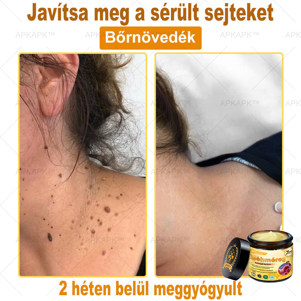 🔥🔥 Már csak 5 lehetőség! Használd ki a 50% kedvezményt! APKAPK® 🐝 Méhméreg krém segít a ráncok, hegek, pigmentfoltok, striák, akné és egyéb bőrproblémák kezelésében. Ne hagyd ki – kattints a linkre és élvezd a kedvezményt még ma! 🛒💚