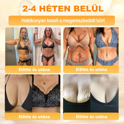 🔥🔥 Már csak 5 lehetőség! Használd ki a 50% kedvezményt! APKAPK® 🐝 Méhméreg krém segít a ráncok, hegek, pigmentfoltok, striák, akné és egyéb bőrproblémák kezelésében. Ne hagyd ki – kattints a linkre és élvezd a kedvezményt még ma! 🛒💚