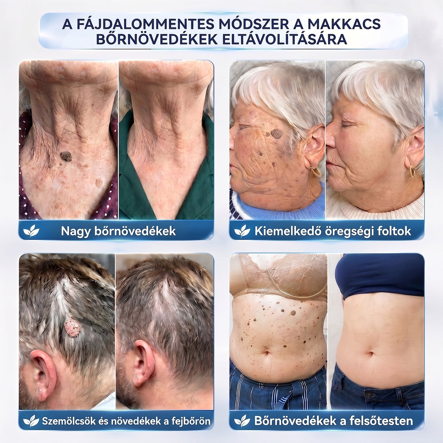 APKAPK® 𝟕 𝐧𝐚𝐩𝐨𝐬 𝐛ő𝐫𝐤𝐢𝐧ö𝐯é𝐬- é𝐬 𝐩𝐢𝐠𝐦𝐞𝐧𝐭𝐟𝐨𝐥𝐭-𝐞𝐥𝐥𝐞𝐧𝐞𝐬 𝐤𝐫é𝐦 (𝐅á𝐣𝐝𝐚𝐥𝐨𝐦𝐦𝐞𝐧𝐭𝐞𝐬 𝐤𝐞𝐳𝐞𝐥é𝐬 – 𝐡𝐞𝐠𝐦𝐚𝐫𝐚𝐝𝐯á𝐧𝐲𝐨𝐤 𝐧é𝐥𝐤ü𝐥)🎉