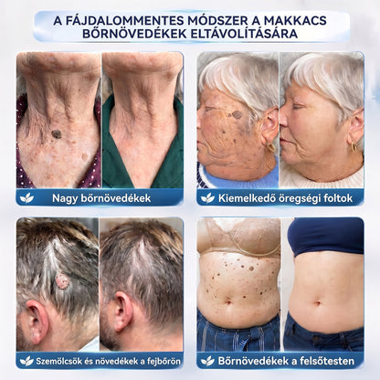 APKAPK® 𝟕 𝐧𝐚𝐩𝐨𝐬 𝐛ő𝐫𝐤𝐢𝐧ö𝐯é𝐬- é𝐬 𝐩𝐢𝐠𝐦𝐞𝐧𝐭𝐟𝐨𝐥𝐭-𝐞𝐥𝐥𝐞𝐧𝐞𝐬 𝐤𝐫é𝐦 (𝐅á𝐣𝐝𝐚𝐥𝐨𝐦𝐦𝐞𝐧𝐭𝐞𝐬 𝐤𝐞𝐳𝐞𝐥é𝐬 – 𝐡𝐞𝐠𝐦𝐚𝐫𝐚𝐝𝐯á𝐧𝐲𝐨𝐤 𝐧é𝐥𝐤ü𝐥)🎉