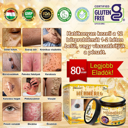 ✨✨ 𝖠𝖯𝖪𝖠𝖯𝖪® 🐝 Méhméreges Bőrmegújító Krém – Ráncok, Hegek, Pigmentfoltok, Striák, Akné, Ekcéma, Pikkelysömör Ellen