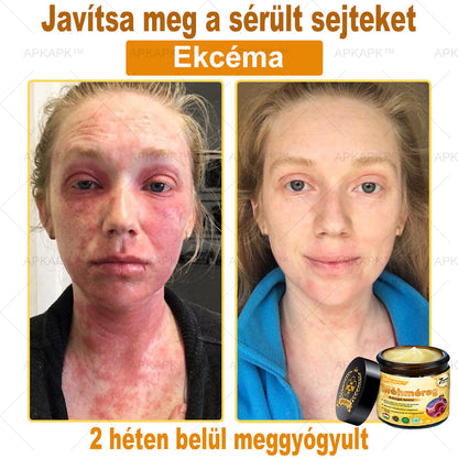 🔥🔥 Már csak 5 lehetőség! Használd ki a 50% kedvezményt! APKAPK® 🐝 Méhméreg krém segít a ráncok, hegek, pigmentfoltok, striák, akné és egyéb bőrproblémák kezelésében. Ne hagyd ki – kattints a linkre és élvezd a kedvezményt még ma! 🛒💚