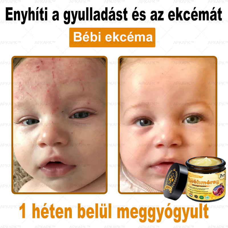 🔥🔥 Már csak 5 lehetőség! Használd ki a 50% kedvezményt! APKAPK® 🐝 Méhméreg krém segít a ráncok, hegek, pigmentfoltok, striák, akné és egyéb bőrproblémák kezelésében. Ne hagyd ki – kattints a linkre és élvezd a kedvezményt még ma! 🛒💚