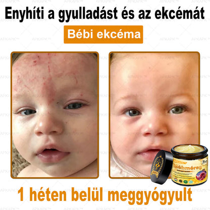🔥🔥 Már csak 5 lehetőség! Használd ki a 50% kedvezményt! APKAPK® 🐝 Méhméreg krém segít a ráncok, hegek, pigmentfoltok, striák, akné és egyéb bőrproblémák kezelésében. Ne hagyd ki – kattints a linkre és élvezd a kedvezményt még ma! 🛒💚