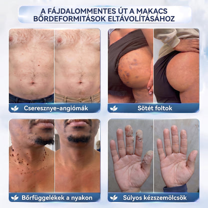 APKAPK® 𝟕 𝐧𝐚𝐩𝐨𝐬 𝐛ő𝐫𝐤𝐢𝐧ö𝐯é𝐬- é𝐬 𝐩𝐢𝐠𝐦𝐞𝐧𝐭𝐟𝐨𝐥𝐭-𝐞𝐥𝐥𝐞𝐧𝐞𝐬 𝐤𝐫é𝐦 (𝐅á𝐣𝐝𝐚𝐥𝐨𝐦𝐦𝐞𝐧𝐭𝐞𝐬 𝐤𝐞𝐳𝐞𝐥é𝐬 – 𝐡𝐞𝐠𝐦𝐚𝐫𝐚𝐝𝐯á𝐧𝐲𝐨𝐤 𝐧é𝐥𝐤ü𝐥)🎉