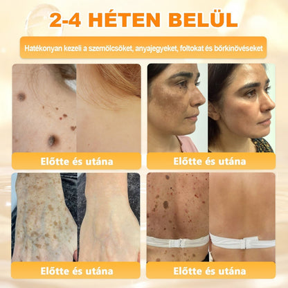 🔥🔥 Már csak 5 lehetőség! Használd ki a 50% kedvezményt! APKAPK® 🐝 Méhméreg krém segít a ráncok, hegek, pigmentfoltok, striák, akné és egyéb bőrproblémák kezelésében. Ne hagyd ki – kattints a linkre és élvezd a kedvezményt még ma! 🛒💚