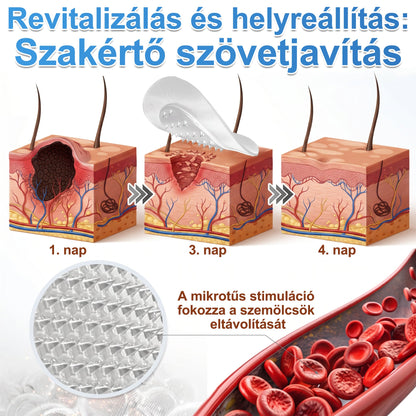 🎁 -50% AKCIÓ! PURESHADE® 2 az 1-ben mikrotűs és hidrokolloid tapasz 🍀 | Láthatatlan tapasz arcra és testre | Bőrhibák, aknék és bőröregedés jeleinek ápolására
