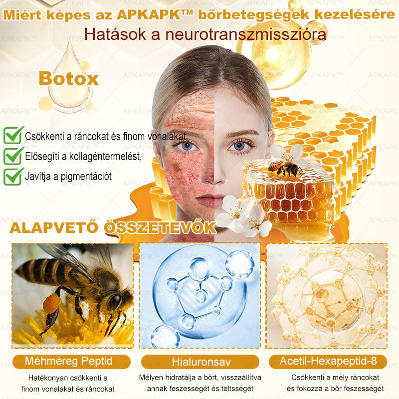 🔥🔥 Már csak 5 lehetőség! Használd ki a 50% kedvezményt! APKAPK® 🐝 Méhméreg krém segít a ráncok, hegek, pigmentfoltok, striák, akné és egyéb bőrproblémák kezelésében. Ne hagyd ki – kattints a linkre és élvezd a kedvezményt még ma! 🛒💚