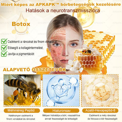 🔥🔥 Már csak 5 lehetőség! Használd ki a 50% kedvezményt! APKAPK® 🐝 Méhméreg krém segít a ráncok, hegek, pigmentfoltok, striák, akné és egyéb bőrproblémák kezelésében. Ne hagyd ki – kattints a linkre és élvezd a kedvezményt még ma! 🛒💚