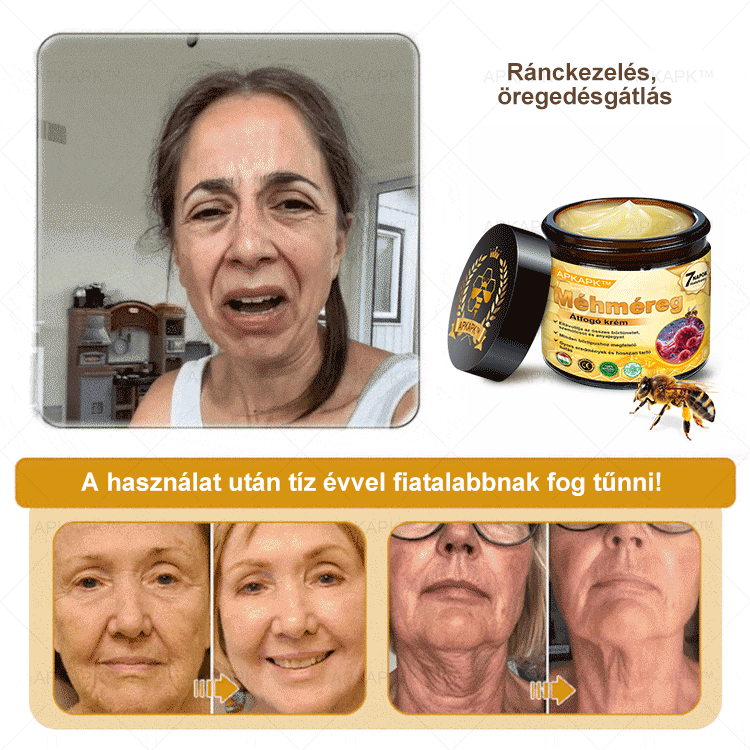 🔥🔥 Már csak 5 lehetőség! Használd ki a 50% kedvezményt! APKAPK® 🐝 Méhméreg krém segít a ráncok, hegek, pigmentfoltok, striák, akné és egyéb bőrproblémák kezelésében. Ne hagyd ki – kattints a linkre és élvezd a kedvezményt még ma! 🛒💚