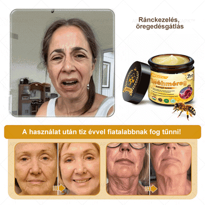 🔥🔥 Már csak 5 lehetőség! Használd ki a 50% kedvezményt! APKAPK® 🐝 Méhméreg krém segít a ráncok, hegek, pigmentfoltok, striák, akné és egyéb bőrproblémák kezelésében. Ne hagyd ki – kattints a linkre és élvezd a kedvezményt még ma! 🛒💚