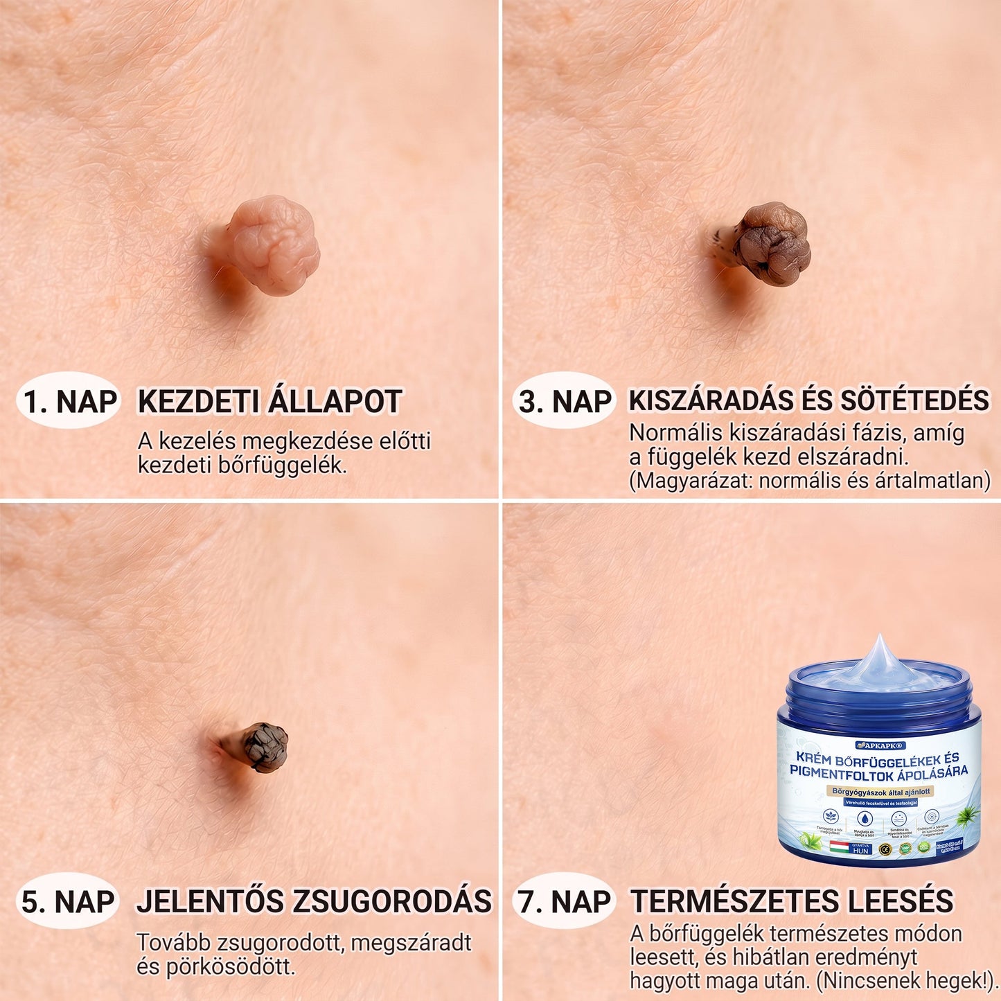 APKAPK® 𝟕 𝐧𝐚𝐩𝐨𝐬 𝐛ő𝐫𝐤𝐢𝐧ö𝐯é𝐬- é𝐬 𝐩𝐢𝐠𝐦𝐞𝐧𝐭𝐟𝐨𝐥𝐭-𝐞𝐥𝐥𝐞𝐧𝐞𝐬 𝐤𝐫é𝐦 (𝐅á𝐣𝐝𝐚𝐥𝐨𝐦𝐦𝐞𝐧𝐭𝐞𝐬 𝐤𝐞𝐳𝐞𝐥é𝐬 – 𝐡𝐞𝐠𝐦𝐚𝐫𝐚𝐝𝐯á𝐧𝐲𝐨𝐤 𝐧é𝐥𝐤ü𝐥)🎉