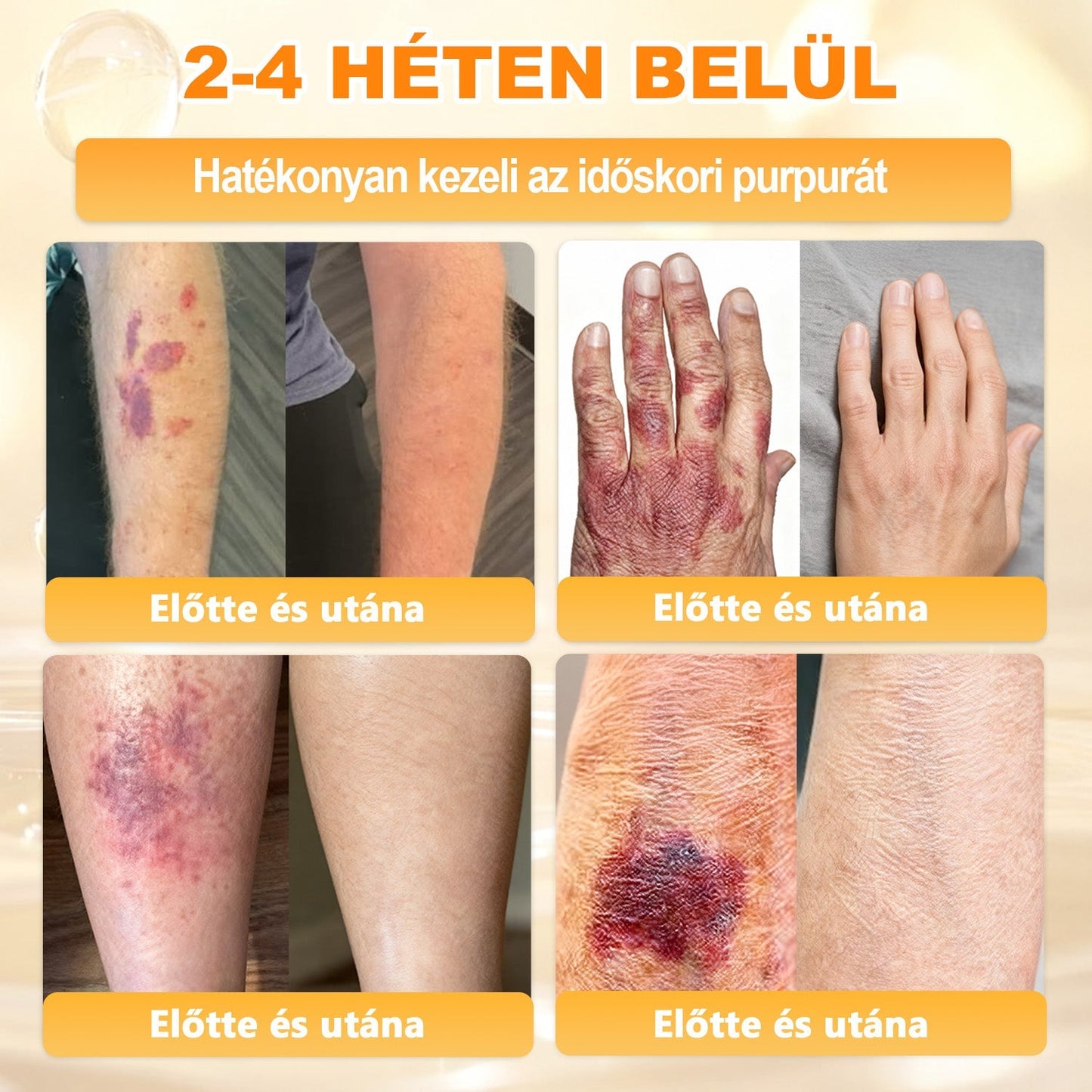 ✨✨ 𝖠𝖯𝖪𝖠𝖯𝖪® 🐝 Méhméreges Bőrmegújító Krém – Ráncok, Hegek, Pigmentfoltok, Striák, Akné, Ekcéma, Pikkelysömör Ellen