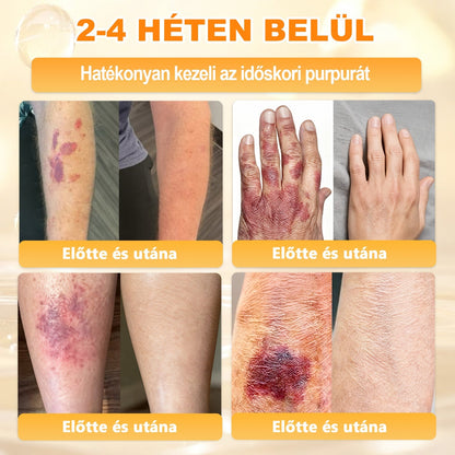✨✨ 𝖠𝖯𝖪𝖠𝖯𝖪® 🐝 Méhméreges Bőrmegújító Krém – Ráncok, Hegek, Pigmentfoltok, Striák, Akné, Ekcéma, Pikkelysömör Ellen