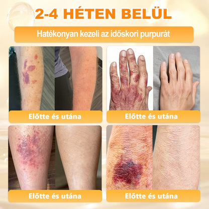 🔥🔥 Már csak 5 lehetőség! Használd ki a 50% kedvezményt! APKAPK® 🐝 Méhméreg krém segít a ráncok, hegek, pigmentfoltok, striák, akné és egyéb bőrproblémák kezelésében. Ne hagyd ki – kattints a linkre és élvezd a kedvezményt még ma! 🛒💚