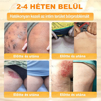 🔥🔥 Már csak 5 lehetőség! Használd ki a 50% kedvezményt! APKAPK® 🐝 Méhméreg krém segít a ráncok, hegek, pigmentfoltok, striák, akné és egyéb bőrproblémák kezelésében. Ne hagyd ki – kattints a linkre és élvezd a kedvezményt még ma! 🛒💚