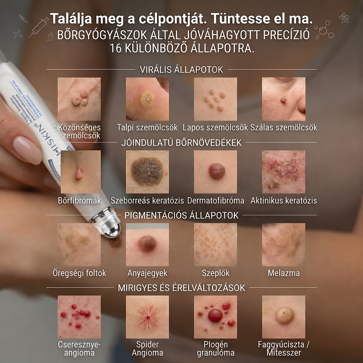 Hivatalos Márkabolt | 🚢 Hiskin® 7 napos Szemölcseltávolító Roll-on Ápoló Folyadék (Fájdalommentes rollerball technológia, hegek nélkül) 🐬