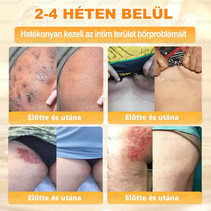 ✨✨ 𝖠𝖯𝖪𝖠𝖯𝖪® 🐝 Méhméreges Bőrmegújító Krém – Ráncok, Hegek, Pigmentfoltok, Striák, Akné, Ekcéma, Pikkelysömör Ellen
