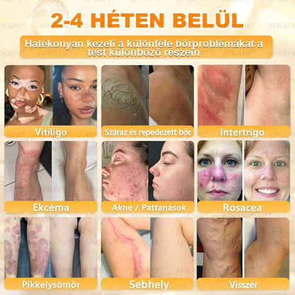 🔥🔥 Már csak 5 lehetőség! Használd ki a 50% kedvezményt! APKAPK® 🐝 Méhméreg krém segít a ráncok, hegek, pigmentfoltok, striák, akné és egyéb bőrproblémák kezelésében. Ne hagyd ki – kattints a linkre és élvezd a kedvezményt még ma! 🛒💚