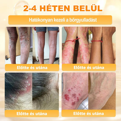 🔥🔥 Már csak 5 lehetőség! Használd ki a 50% kedvezményt! APKAPK® 🐝 Méhméreg krém segít a ráncok, hegek, pigmentfoltok, striák, akné és egyéb bőrproblémák kezelésében. Ne hagyd ki – kattints a linkre és élvezd a kedvezményt még ma! 🛒💚