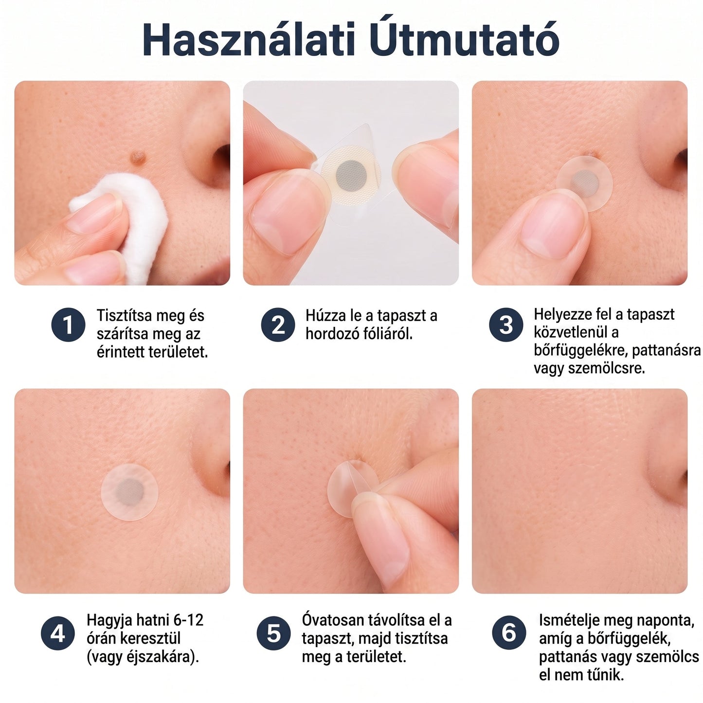 🎁 -50% AKCIÓ! PURESHADE® 2 az 1-ben mikrotűs és hidrokolloid tapasz 🍀 | Láthatatlan tapasz arcra és testre | Bőrhibák, aknék és bőröregedés jeleinek ápolására
