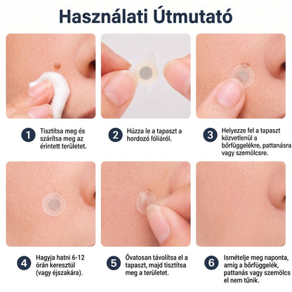 🎁 -50% AKCIÓ! PURESHADE® 2 az 1-ben mikrotűs és hidrokolloid tapasz 🍀 | Láthatatlan tapasz arcra és testre | Bőrhibák, aknék és bőröregedés jeleinek ápolására