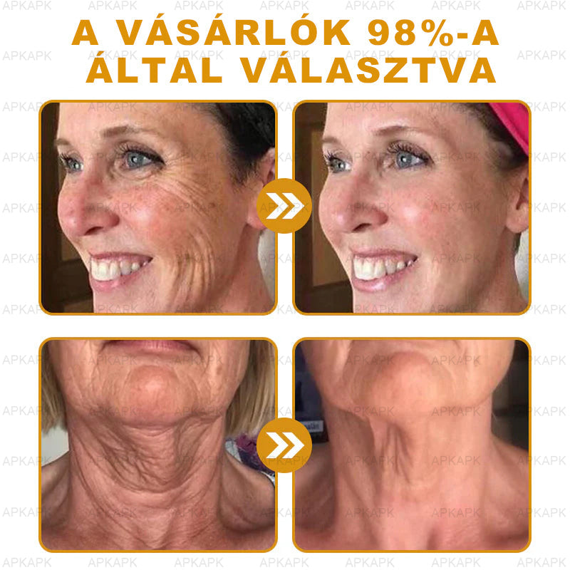 🔥🔥 Már csak 5 lehetőség! Használd ki a 50% kedvezményt! APKAPK® 🐝 Méhméreg krém segít a ráncok, hegek, pigmentfoltok, striák, akné és egyéb bőrproblémák kezelésében. Ne hagyd ki – kattints a linkre és élvezd a kedvezményt még ma! 🛒💚