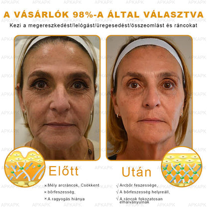 🔥🔥 Már csak 5 lehetőség! Használd ki a 50% kedvezményt! APKAPK® 🐝 Méhméreg krém segít a ráncok, hegek, pigmentfoltok, striák, akné és egyéb bőrproblémák kezelésében. Ne hagyd ki – kattints a linkre és élvezd a kedvezményt még ma! 🛒💚